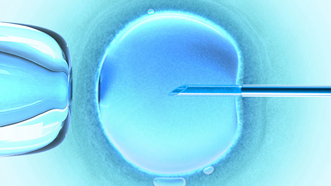 IVF - the procedure itself freaks me out.